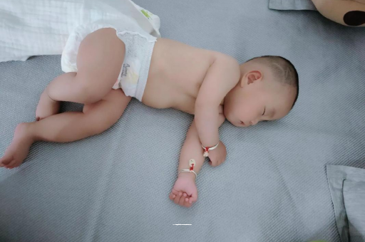 湘潭宝宝头上长痱子